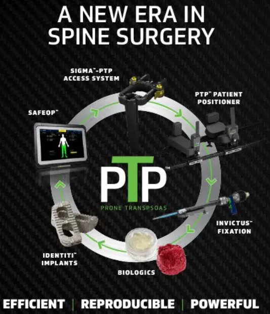 Prone TransPsoas (PTP) Lumbar Interbody Fusion